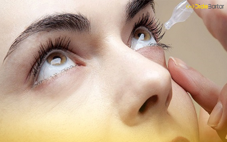 روشهای پیشگیری از ناخنک چشم