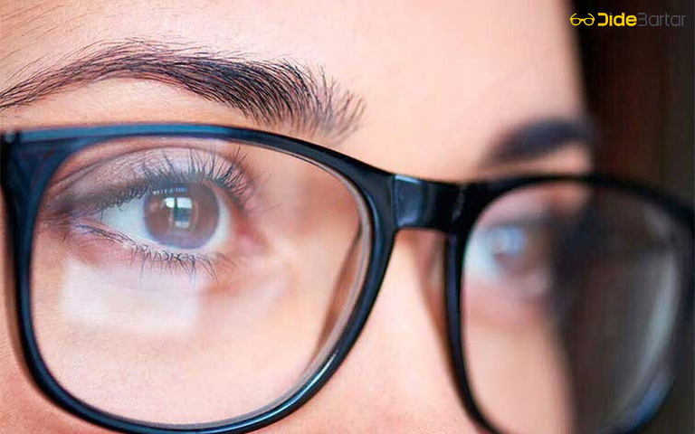 کیفیت و نوع عدسیها