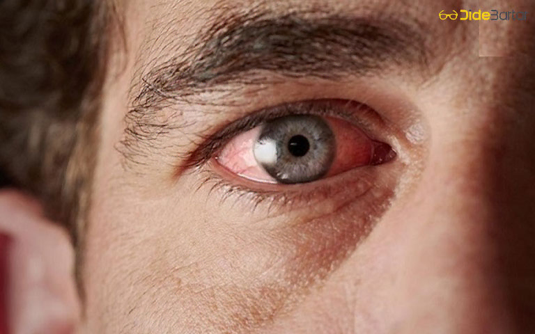 علائم و نشانهها