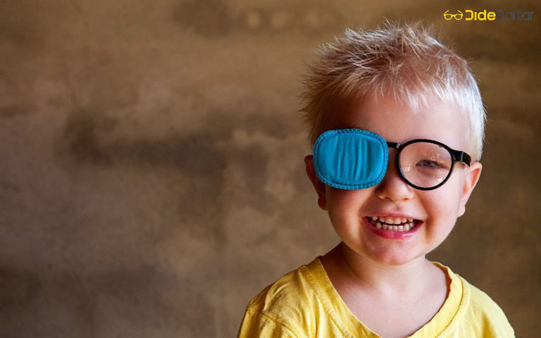 تفاوتهای اصلی بین تنبلی چشم و ضعیفی چشم