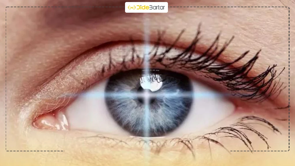 علائم آستیگماتیسم