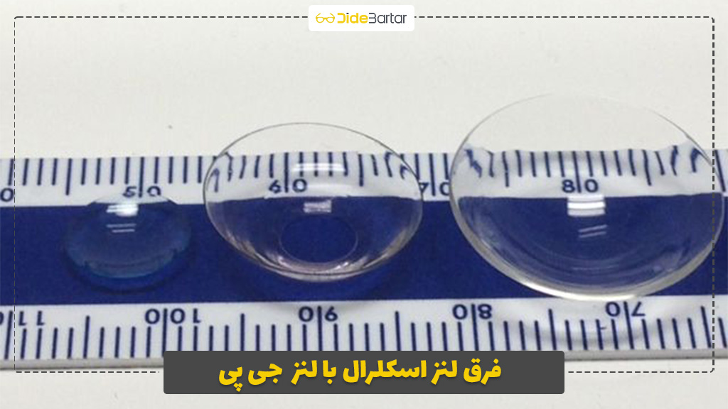 فرق لنز اسکلرال با لنز GP