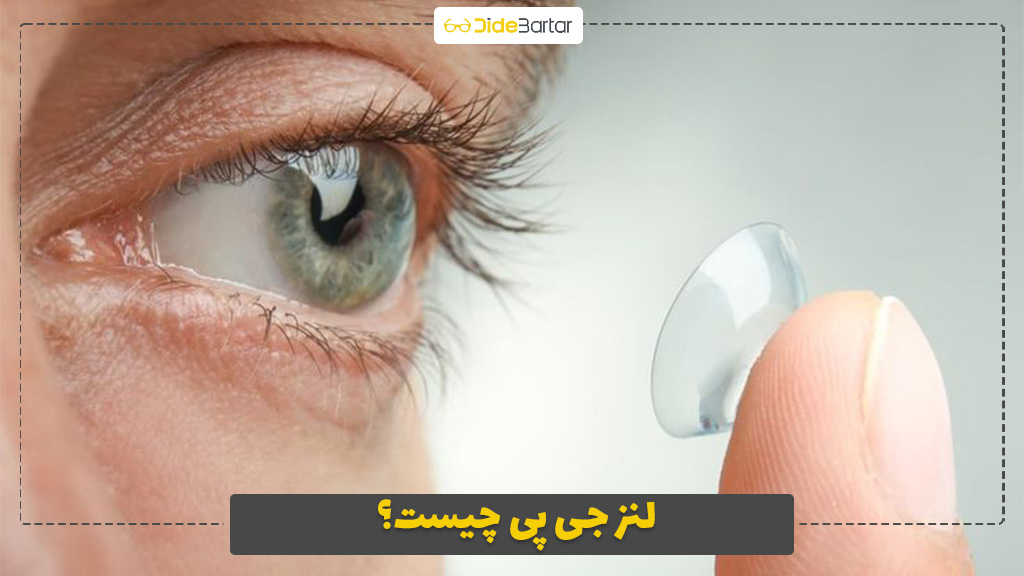 لنز جی پی چیست؟