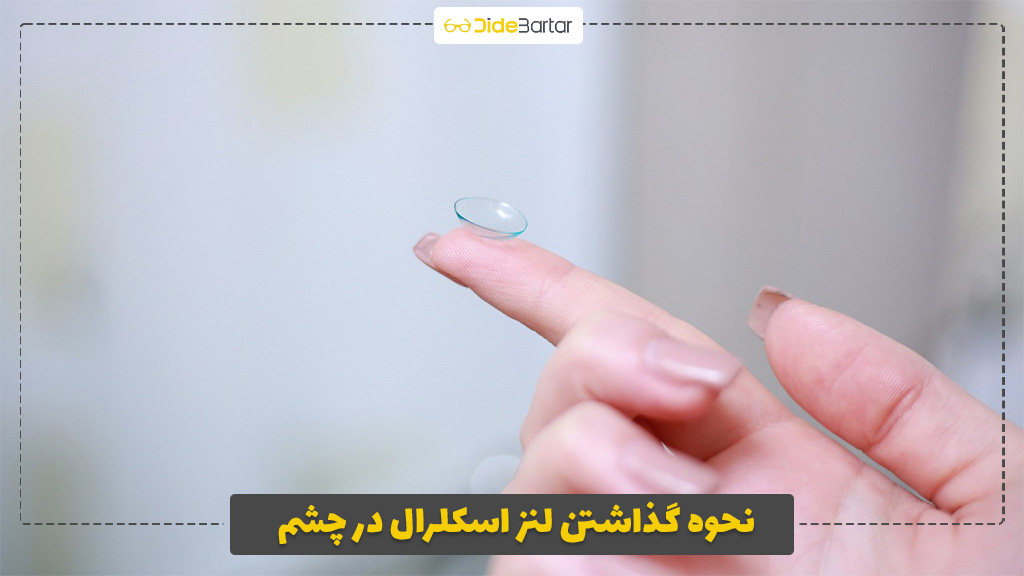 نحوه گذاشتن لنز اسکلرال در چشم