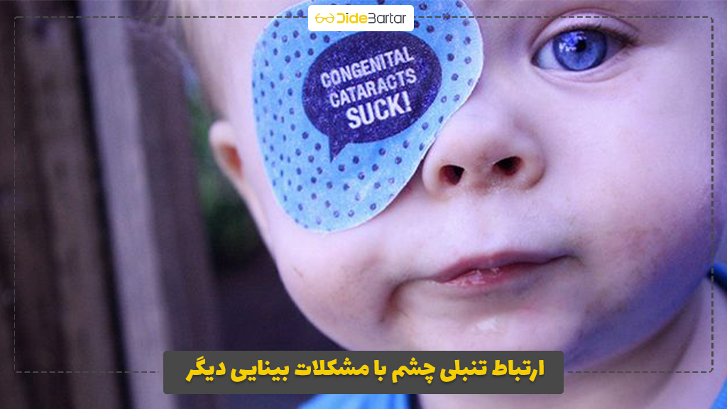 ارتباط تنبلی چشم با مشکلات بینایی دیگر