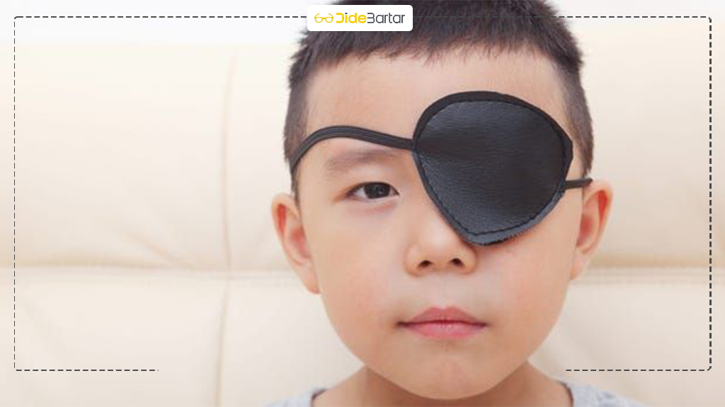 درمان تنبلی چشم با عینک