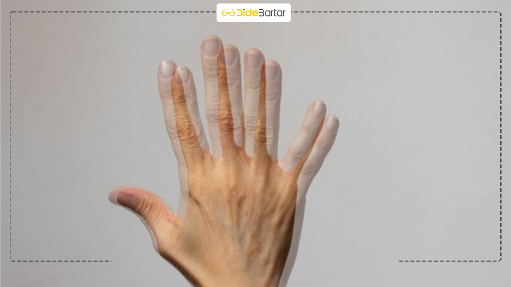 فرق دوبینی با آستیگماتیسم