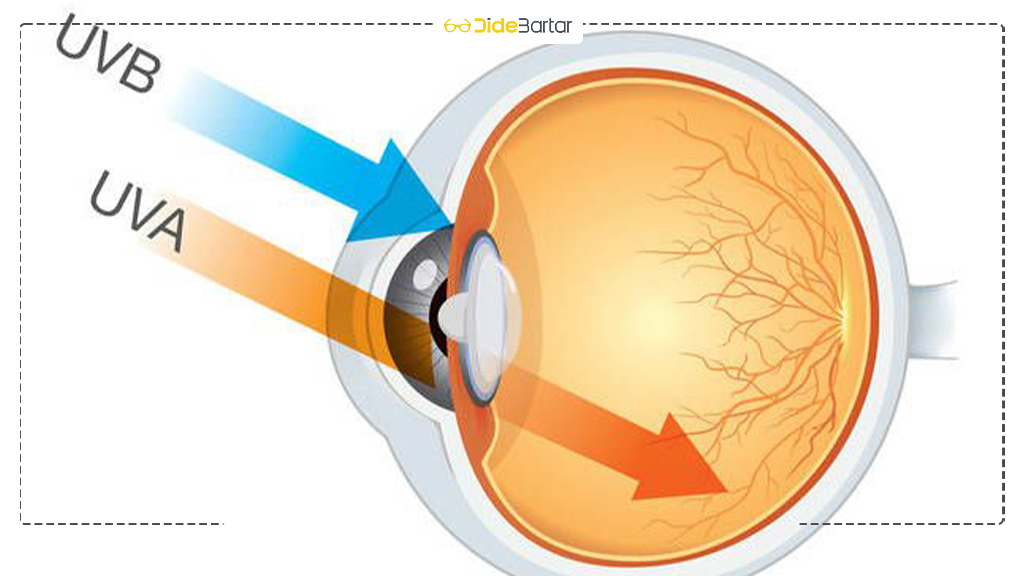 تأثیر اشعه UV بر چشم و راه‌ های محافظت