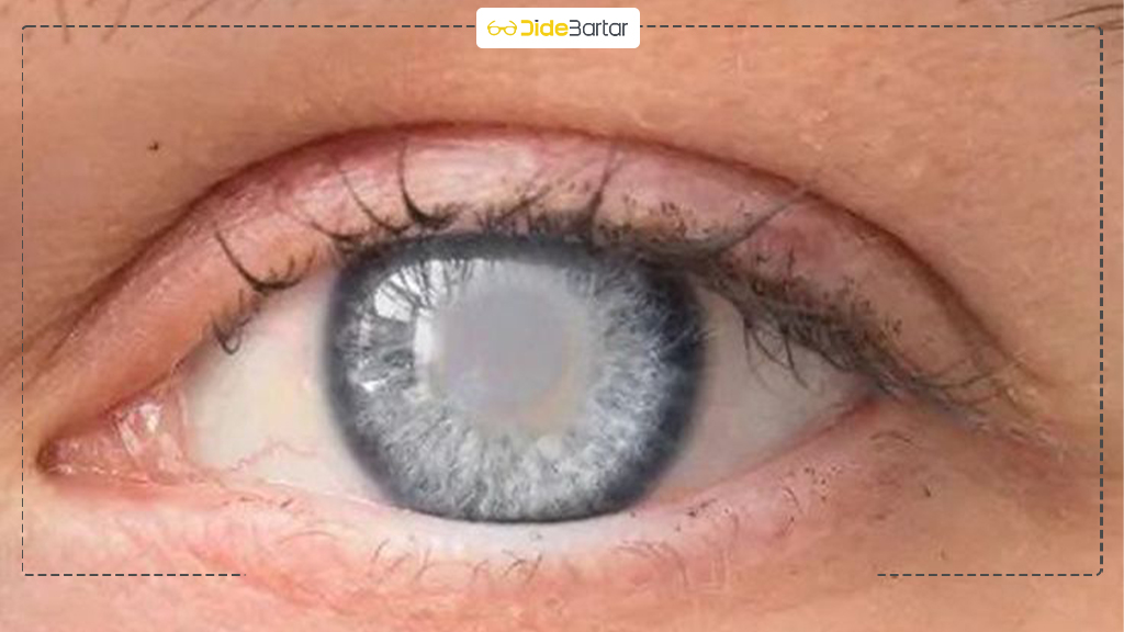 تفاوت عینک پلاریزه و عینک UV