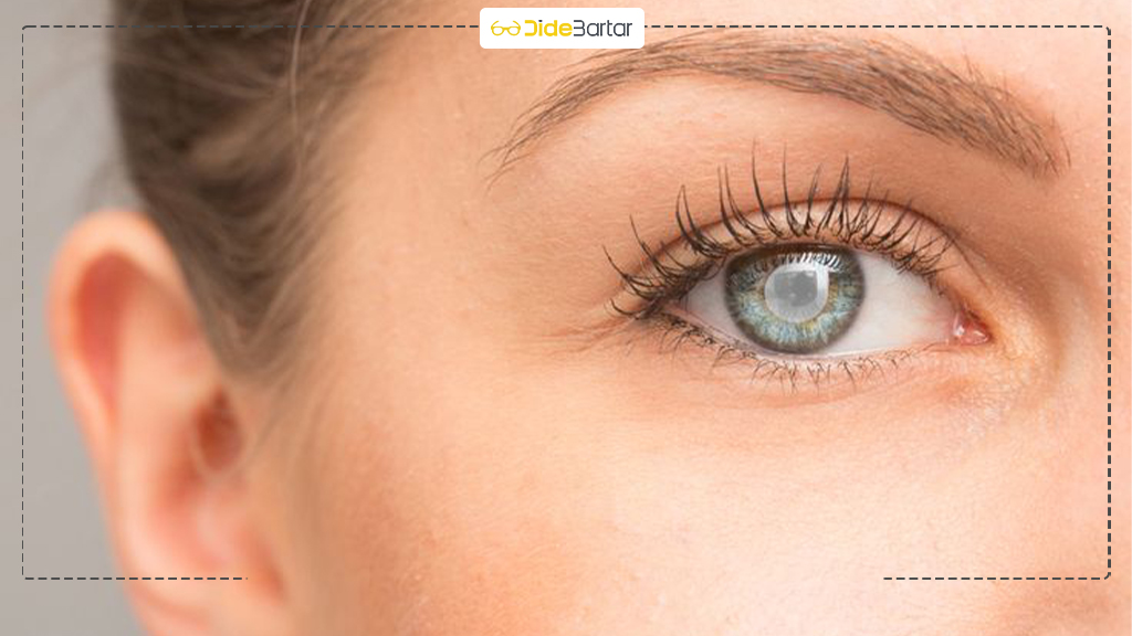 ارتباط دیابت با بیماری‌ های چشمی