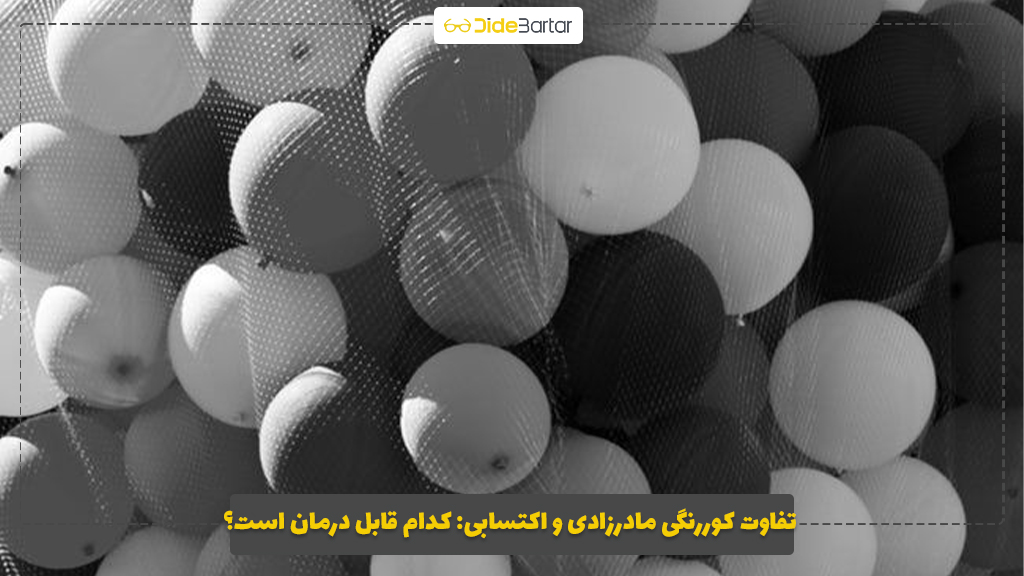 تفاوت کوررنگی مادرزادی و اکتسابی: کدام قابل درمان است؟