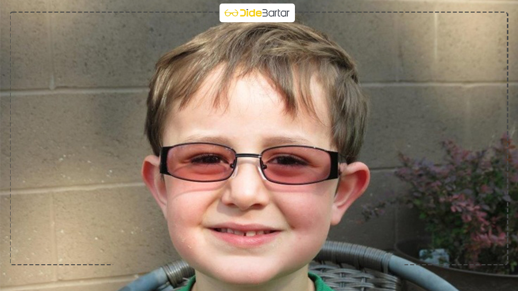 تفاوت کوررنگی مادرزادی و اکتسابی: کدام قابل درمان است؟