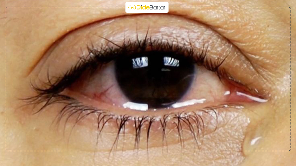 علائم هشدار دهنده ضعف بینایی که نباید نادیده بگیرید