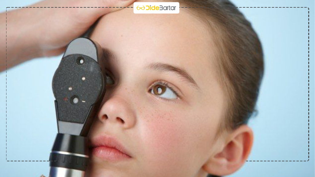 چطور بفهمیم که کودک نیاز به عینک دارد؟ نشانه‌ هایی که والدین باید بدانند