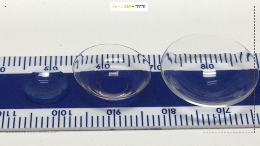 لنز اسکلرال در سقز